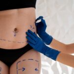 ¿Es seguro realizarse varios procedimientos estéticos en una sola cirugía?