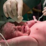 Parto vaginal o cesárea: beneficios y riesgos de las diferentes formas de dar a luz
