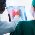 Cáncer pulmonar: la importancia del diagnóstico temprano